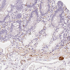 Immunohistochemical staining of human duodenum shows strong cytoplasmic positivity in the peripheral ganglion.
