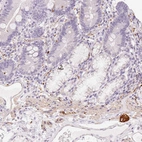 Immunohistochemical staining of human duodenum shows strong cytoplasmic positivity in the peripheral ganglion.