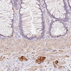 Immunohistochemical staining of human rectum shows strong cytoplasmic positivity in the peripheral ganglion.