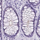 Immunohistochemical staining of human colon using Anti-MPP5 antibody HPA063890.