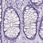 Immunohistochemical staining of human colon using Anti-MPP5 antibody HPA063890.