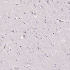 Immunohistochemical staining of human cerebral cortex shows no positivity in neurons as expected.