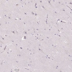 Immunohistochemical staining of human cerebral cortex shows no positivity in neurons as expected.