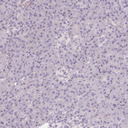 Immunohistochemical staining of human pancreas shows no positivity in exocrine glandular cells as expected.