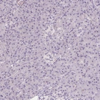 Immunohistochemical staining of human pancreas shows no positivity in exocrine glandular cells as expected.