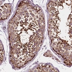 Immunohistochemical staining of human testis shows high expression.