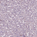 Anti-ATG16L1 Antibody