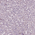 Immunohistochemical staining of human liver shows low expression as expected.