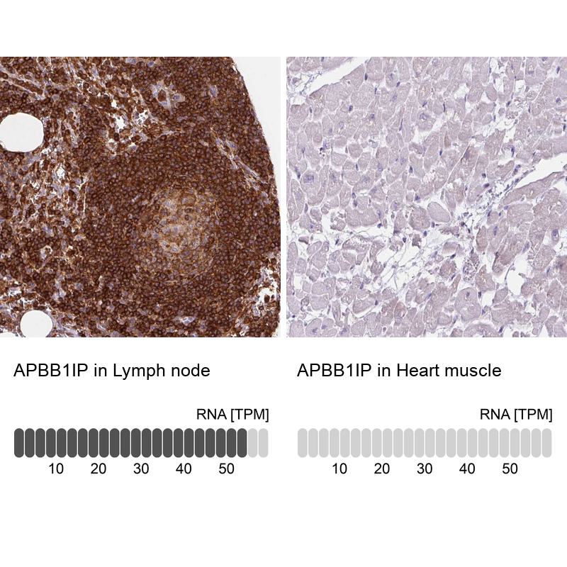 Anti-APBB1IP Antibody