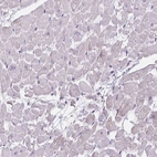 Immunohistochemical staining of human heart muscle shows no positivity in cardiomyocytes as expected.