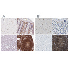 Immunohistochemical staining of human cerebral cortex, colon, heart muscle and lymph node using Anti-APBB1IP antibody HPA063903 (A) shows similar protein distribution across tissues to independent antibody HPA017009 (B).