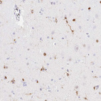 Immunohistochemical staining of human cerebral cortex shows strong cytoplasmic positivity in glial cells.