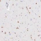 Immunohistochemical staining of human cerebral cortex shows strong cytoplasmic positivity in glial cells.