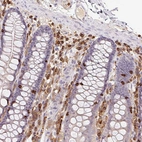 Immunohistochemical staining of human colon shows strong cytoplasmic positivity in lymphoid cells.