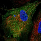 Immunofluorescent staining of human cell line BJ shows localization to plasma membrane & cytosol.