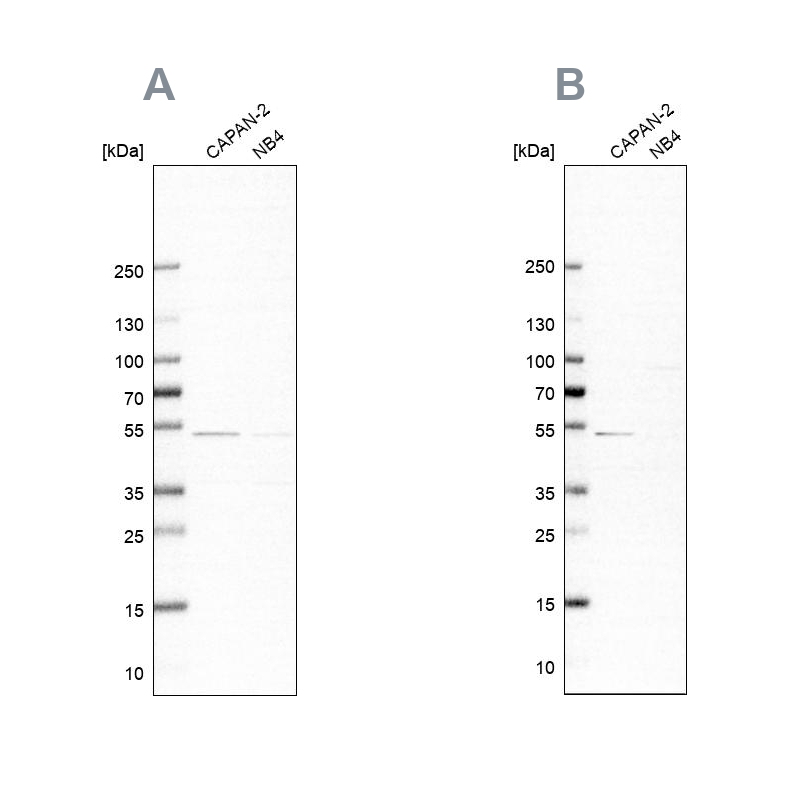 Anti-SPTLC1 Antibody