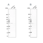 Anti-SPTLC1 Antibody