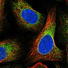 Immunofluorescent staining of human cell line U-2 OS shows localization to endoplasmic reticulum.