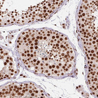 Immunohistochemical staining of human testis shows strong nuclear positivity in cells in seminiferous ducts.