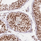 Immunohistochemical staining of human testis shows strong nuclear positivity in cells in seminiferous ducts.