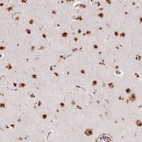 Immunohistochemical staining of human cerebral cortex shows strong nuclear positivity in neurons.