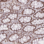 Immunohistochemical staining of human colon shows strong nuclear positivity in glandular cells.