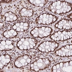 Immunohistochemical staining of human colon shows strong nuclear positivity in glandular cells.