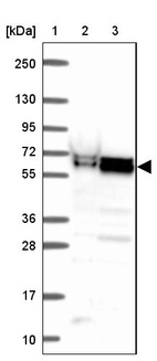 Lane 1: Marker [kDa] 250, 130, 95, 72, 55, 36, 28, 17, 10_br/_Lane 2: Human cell line RT-4_br/_Lane 3: Human cell line U-251 MG