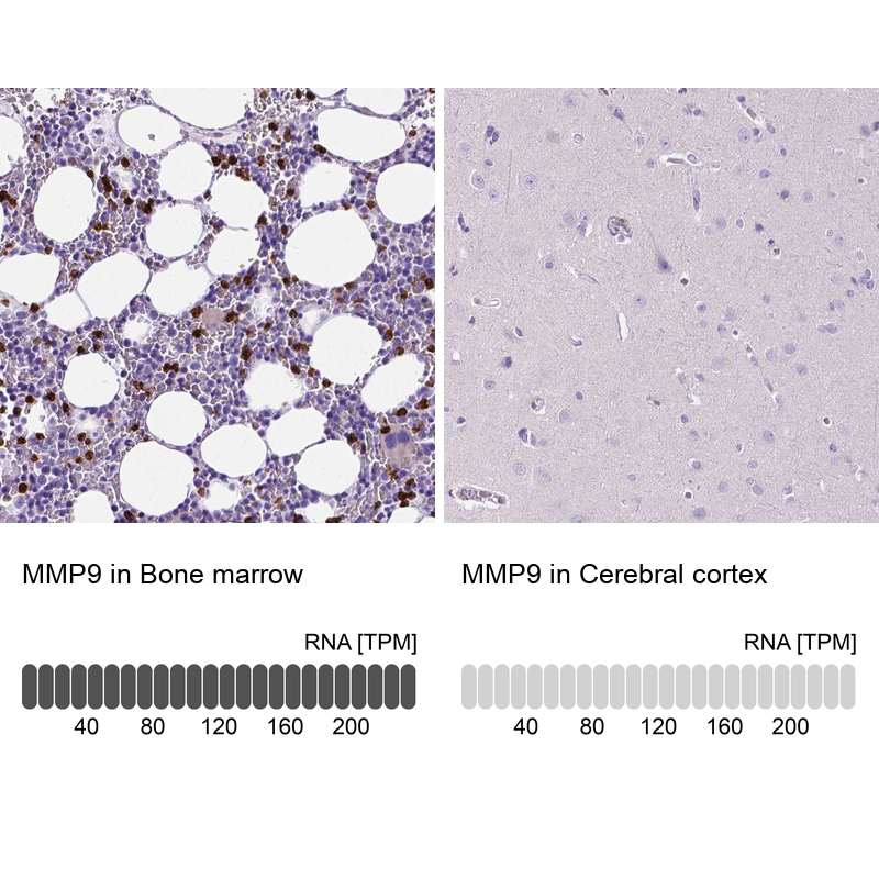 Anti-MMP9 Antibody