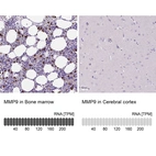 Anti-MMP9 Antibody