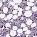 Immunohistochemical staining of human bone marrow shows strong cytoplasmic positivity in hematopoietic cells.