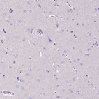 Immunohistochemical staining of human cerebral cortex shows no positivity in neurons as expected.
