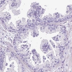Immunohistochemical staining of human prostate shows no positivity in glandular cells as expected.