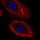 Anti-IL20RB Antibody