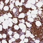 Immunohistochemical staining of human bone marrow shows high expression.