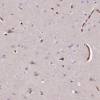 Immunohistochemical staining of human cerebral cortex shows low expression as expected.
