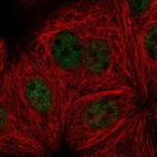 Immunofluorescent staining of human cell line MCF7 shows localization to nucleoplasm.
