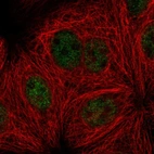 Immunofluorescent staining of human cell line MCF7 shows localization to nucleoplasm.