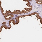 Immunohistochemical staining of human prostate shows high expression.
