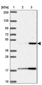 Lane 1: Marker [kDa] 250, 130, 95, 72, 55, 36, 28, 17, 10_br/_Lane 2: Human cell line RT-4_br/_Lane 3: Human cell line U-251 MG