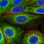 Anti-SCD Antibody
