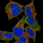 Immunofluorescent staining of human cell line SH-SY5Y shows localization to cytosol.
