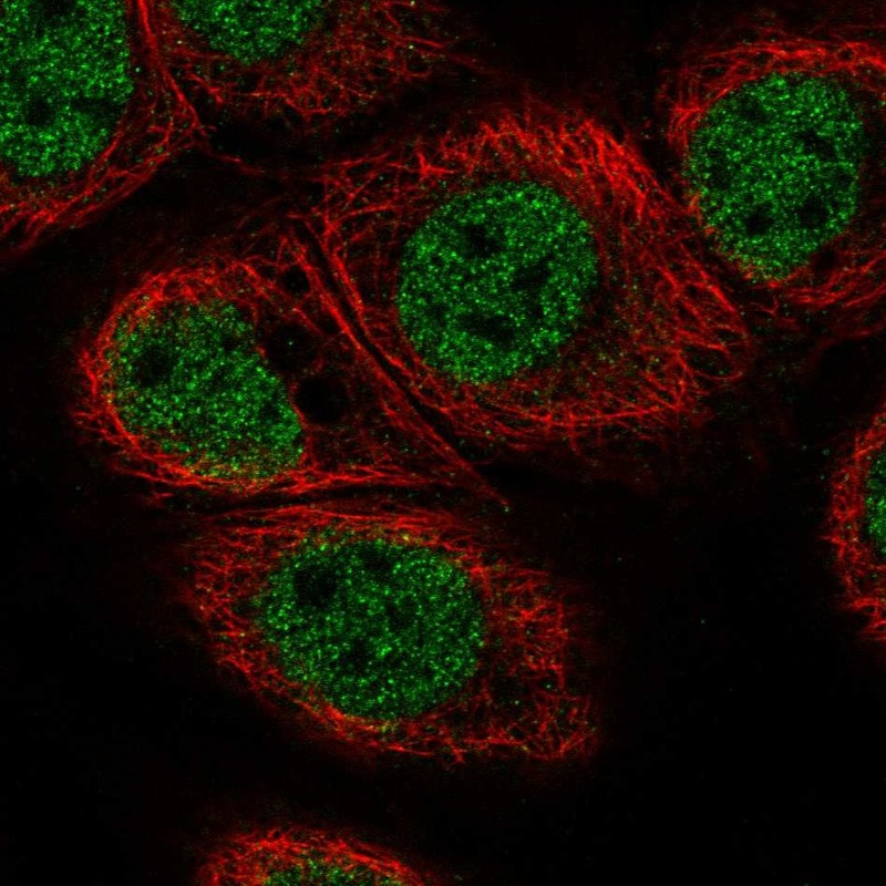 Anti-C11orf71 Antibody