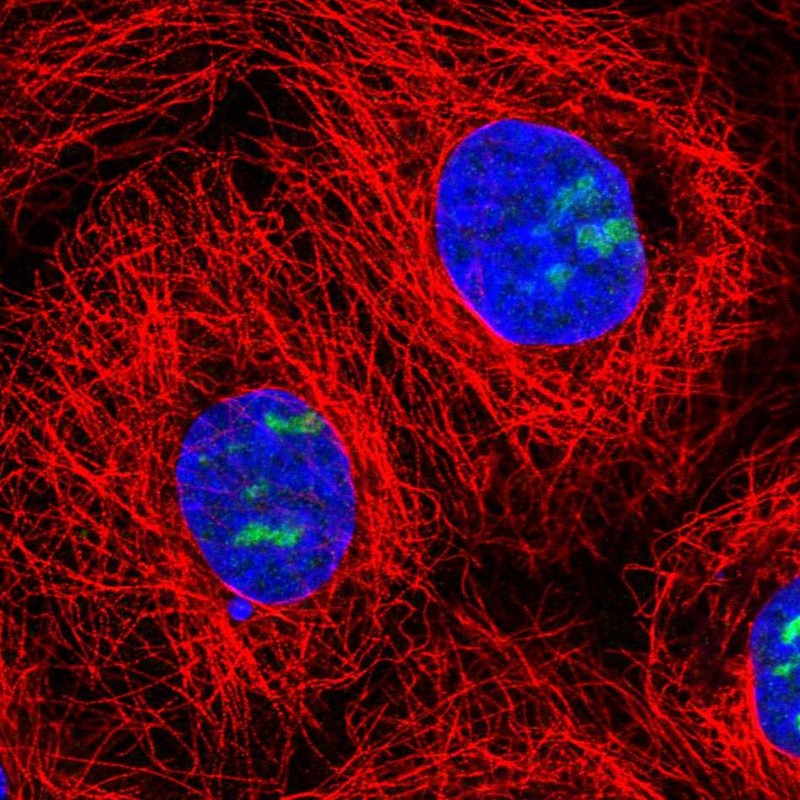 Anti-NOC3L Antibody
