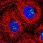 Anti-NOC3L Antibody