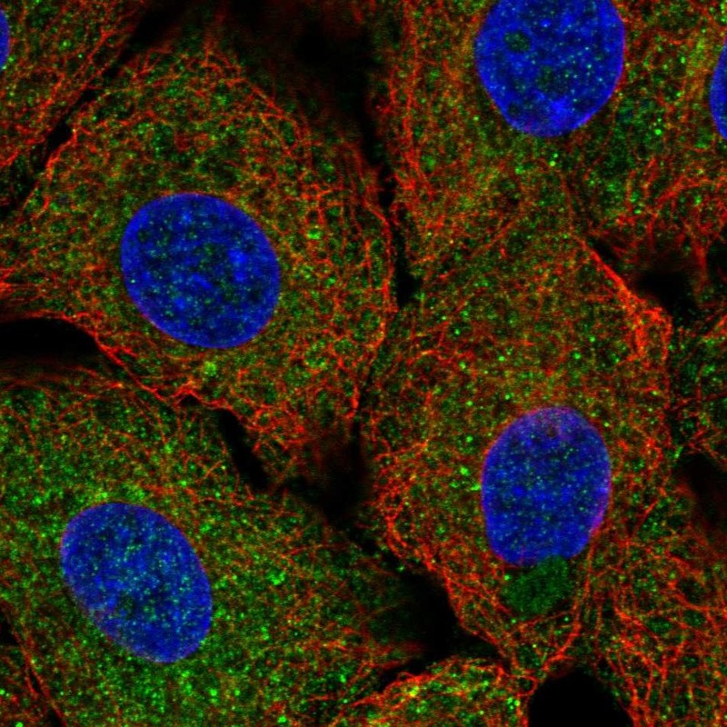 Anti-ULK1 Antibody