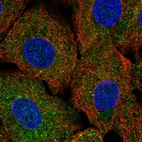 Anti-ULK1 Antibody