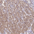 Anti-EXOC6B Antibody