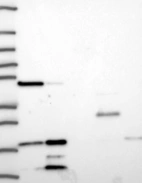 Lane 1: Marker [kDa] 250, 130, 95, 72, 55, 36, 28, 17, 10 | Lane 2: RT4 | Lane 3: U-251 MG | Lane 4: Human Plasma | Lane 5: Liver | Lane 6: Tonsil
