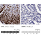 Anti-NPPA Antibody